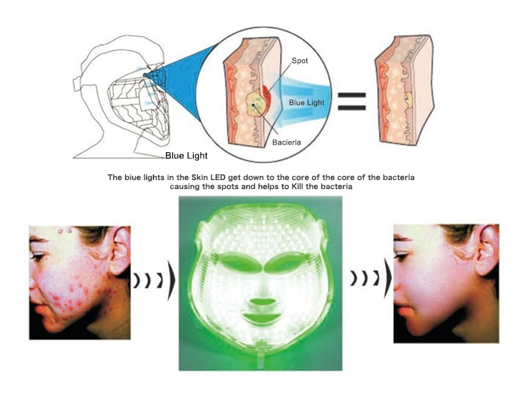 7‑color Led Facial Therapy Mask (1)