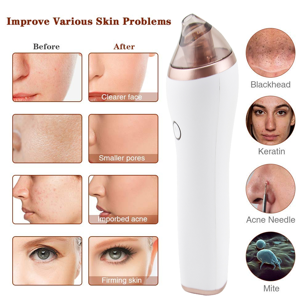 Visible Vacuum Pore Cleaner With 4 Heads (6)